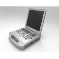 DW-C60PLUS color Doppler médico ultrasonido escáner de China para la venta